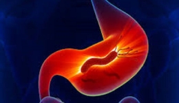 هلیکو باکتر پیلوری و روشهای تشخیص آن