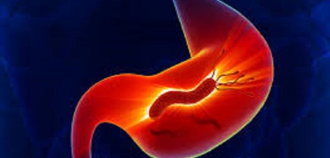 هلیکو باکتر پیلوری و روشهای تشخیص آن