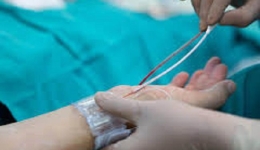 اقدامات و توصیه های قبل از آنژیوگرافی