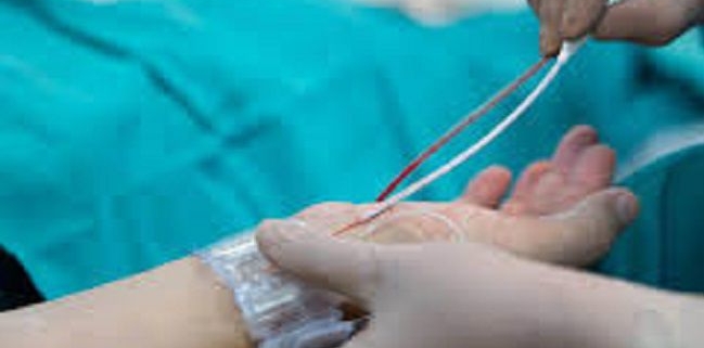 اقدامات و توصیه های قبل از آنژیوگرافی