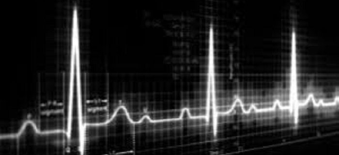 تفسیر ECG برای پرستاران