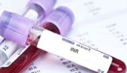 پرسش و پاسخ درباره آزمایشات PT , PTT