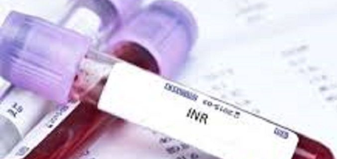 پرسش و پاسخ درباره آزمایشات PT , PTT