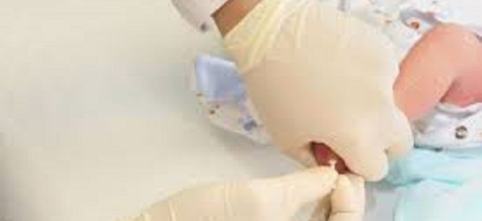 دستورالعمل کشوری پیشگیری و کنترل فنیل کتونوری (PKU)